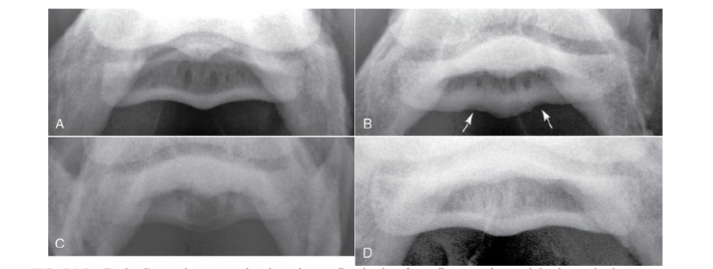 S Ndrome Do Navicular Sinais Cl Nicos E Tratamento Blog Equinovet