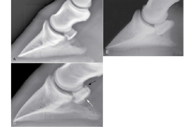 Projeções-laterais do osso navicular