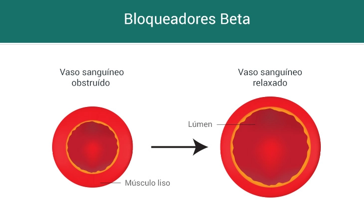 tratamento sindrome do navicular