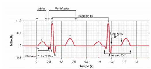 Eletrocardiograma