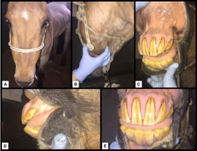 Deformação na osteodistrofia fibrosa