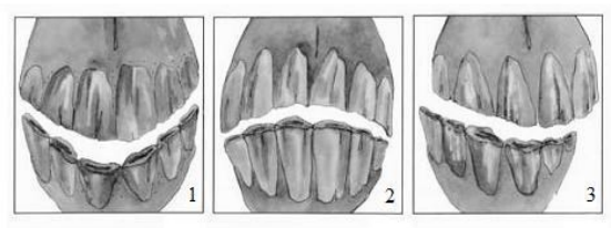 curvaturas odontologia equina