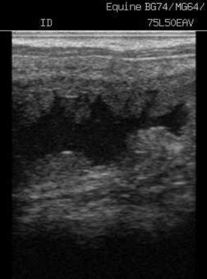 ultrassonografia do utero