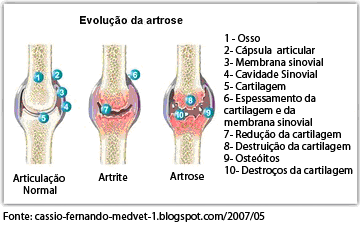 Variações da artrite